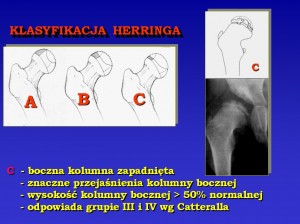 Prezentacja2_typC